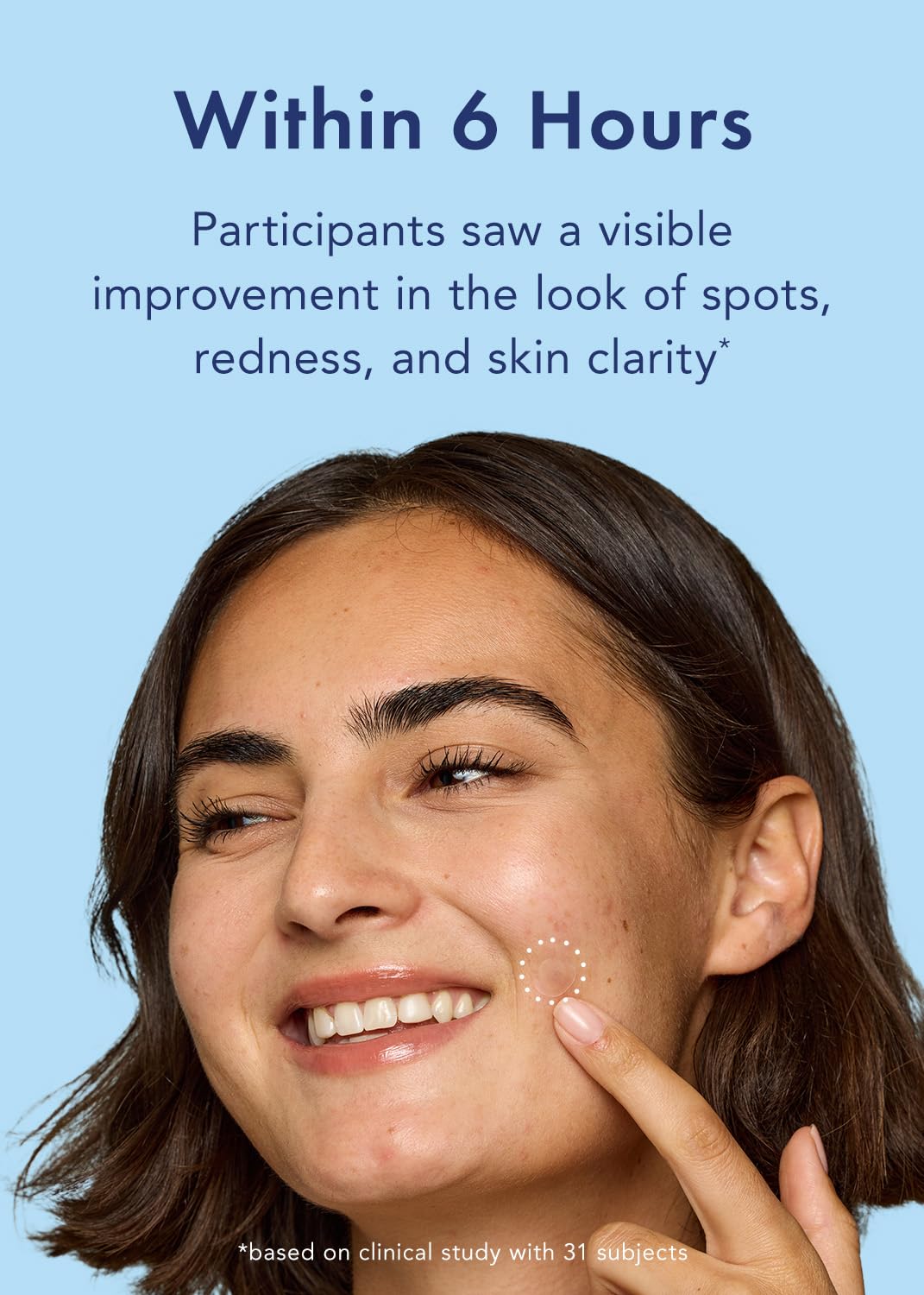 Rael pimple patches use medical grade hydrocolloid to protect skin.