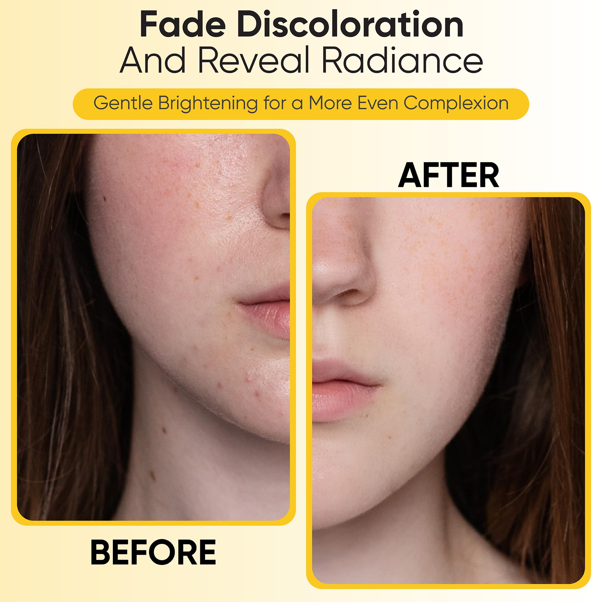 RAXACA Dark spot and pore care pads highlighting refined pores.