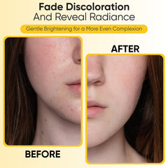 RAXACA Dark spot and pore care pads highlighting refined pores.
