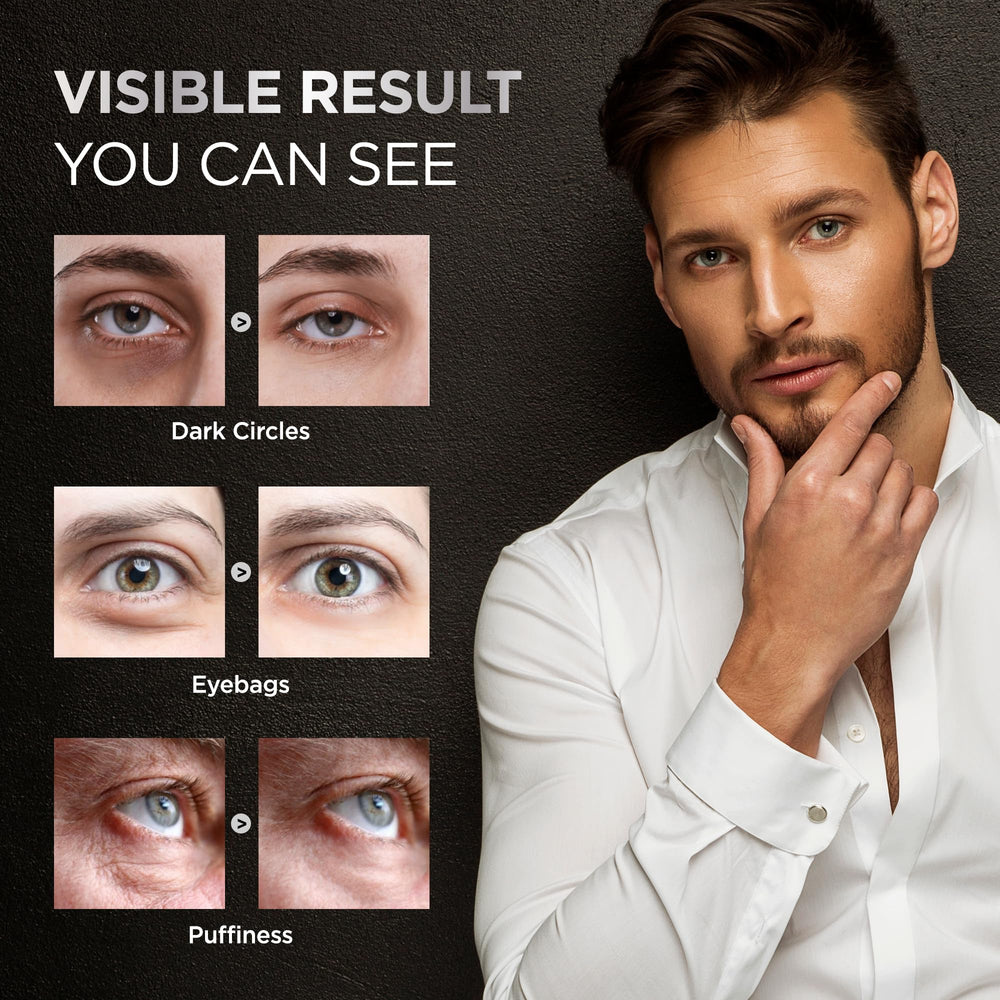 RAZONIX tratamiento bolsas ojos: reduce hinchazón y apariencia cansada.
