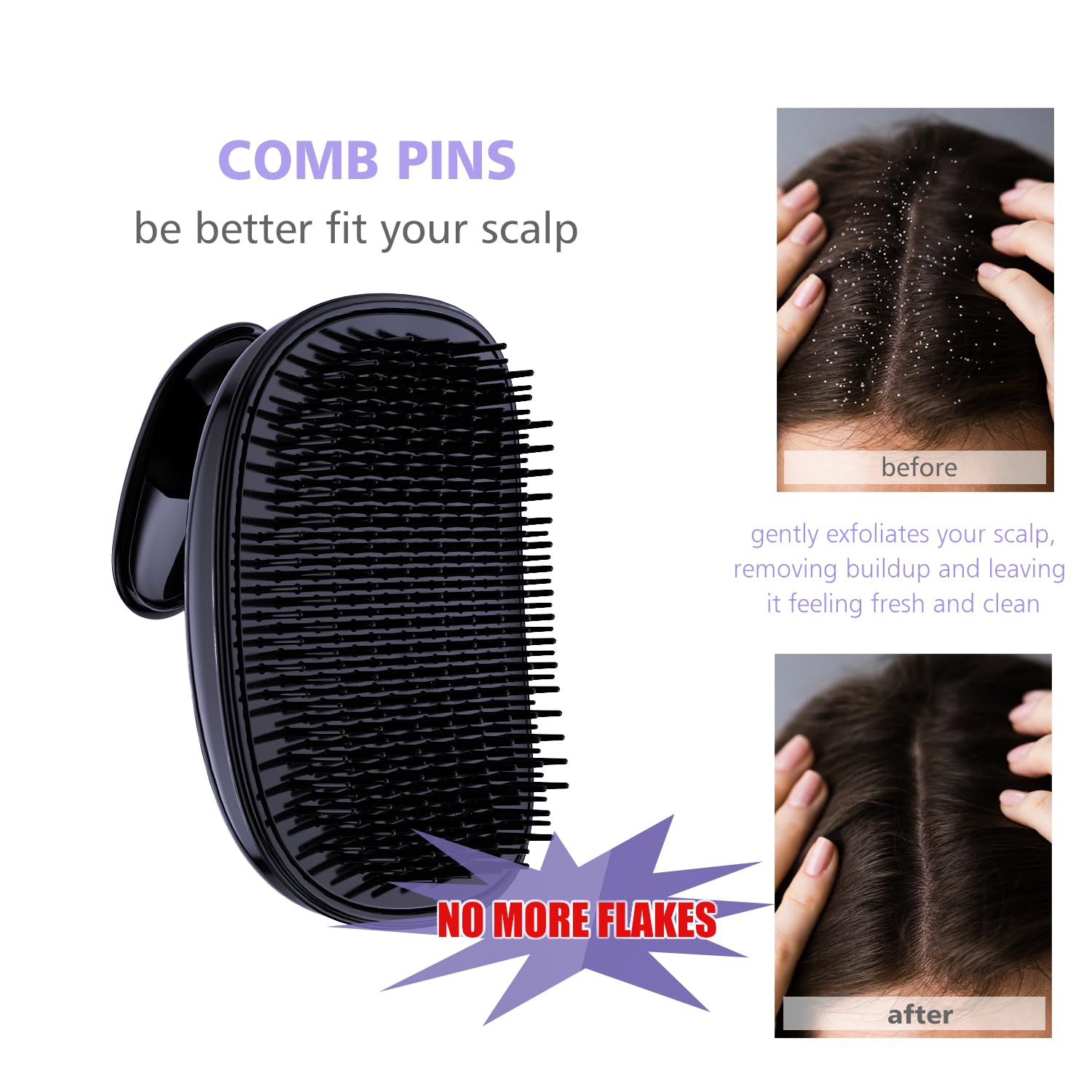 Rebex two-layer scalp scrubber combines cleansing and exfoliation for healthier roots.