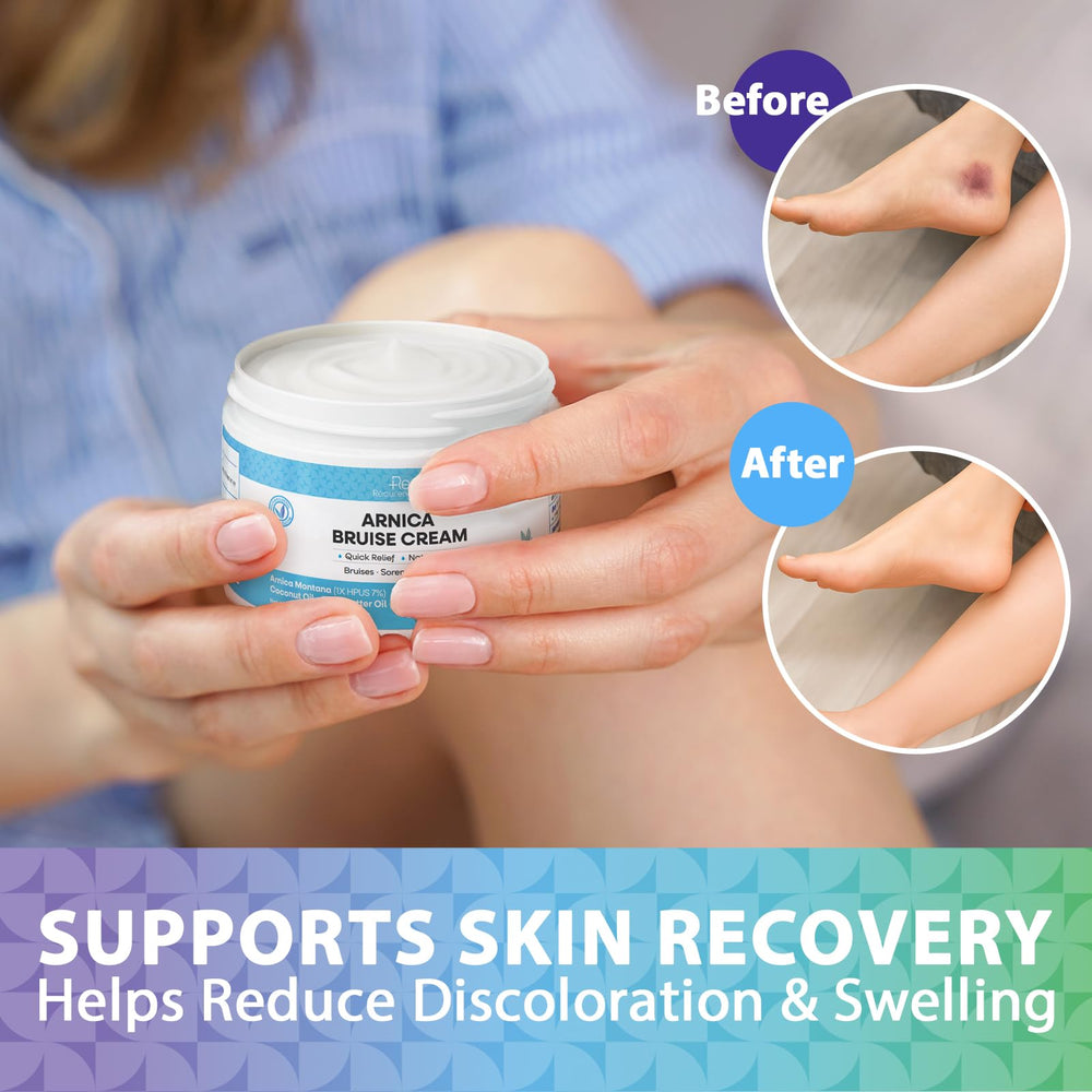 Recuren Plus gentle plant-based care after minor bumps.