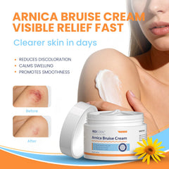 Close-up texture of Redcool Arnica Cream for smooth application.