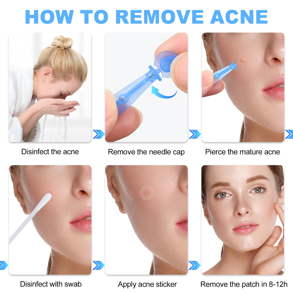 Refesta portable acne tool for on-the-go skincare routine