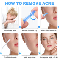 Refesta portable acne tool for on-the-go skincare routine