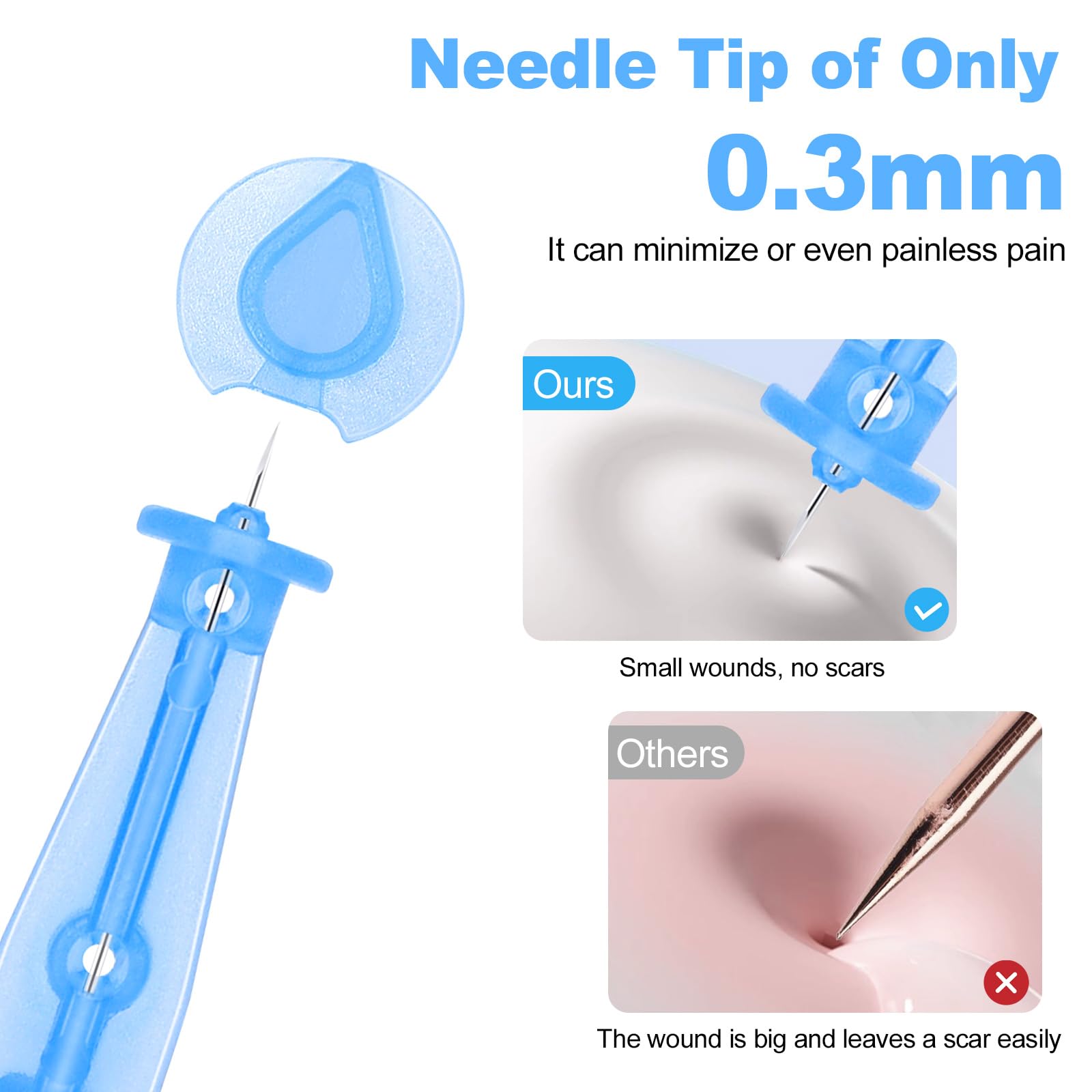 Refesta ultrafine 0.3mm needle tip enables precise blackhead removal