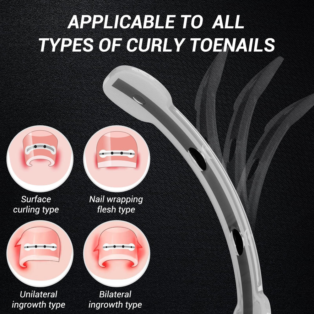 Reieset curved-nail treatment in use during routine care