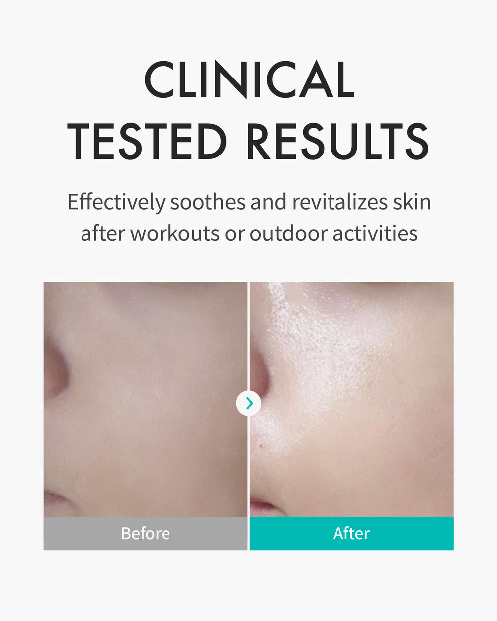 REJURAN mascarilla c-PDRN con textura suave para piel sensible.