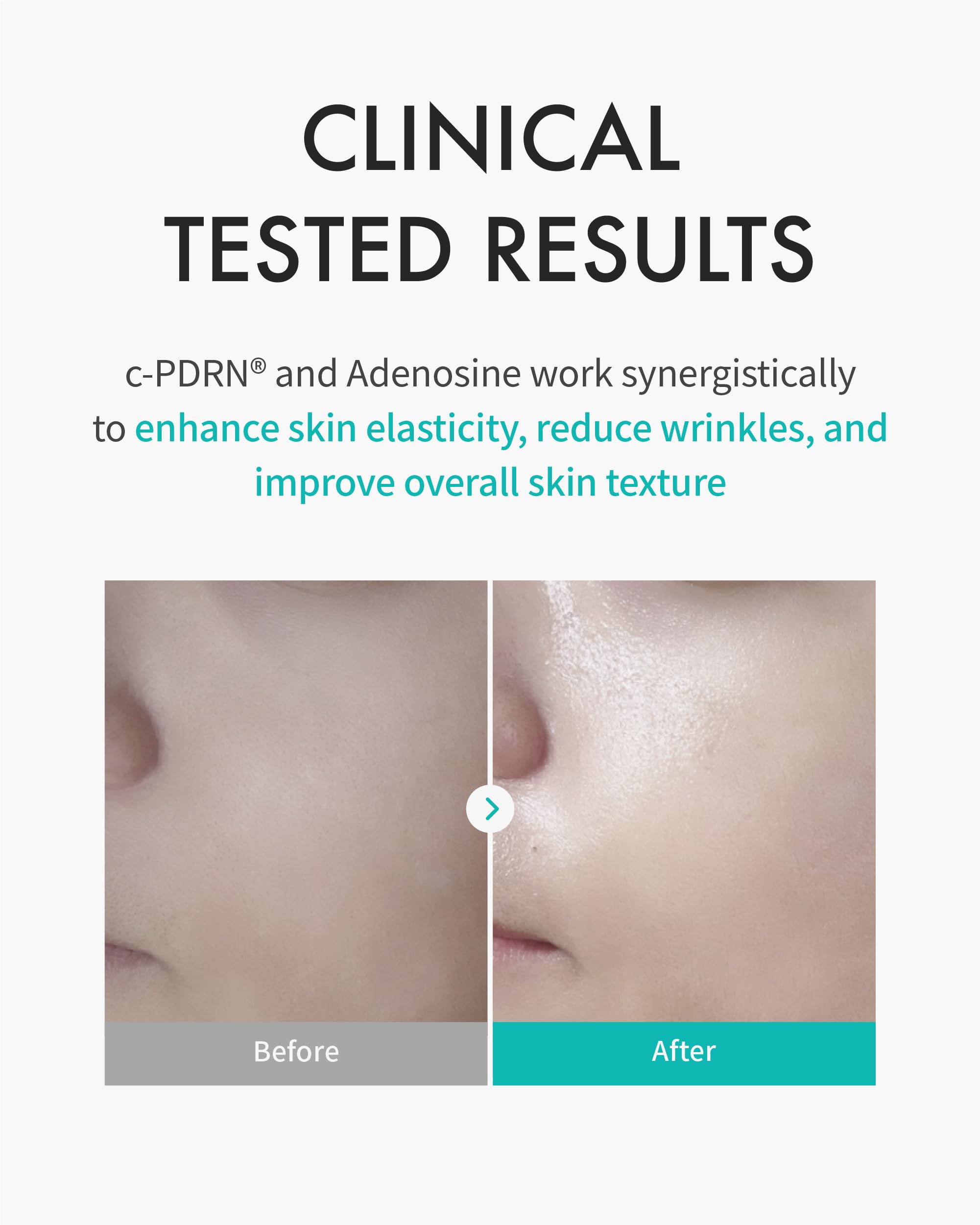Mascarilla REJURAN aplicada en rostro, piel suave y nutrida