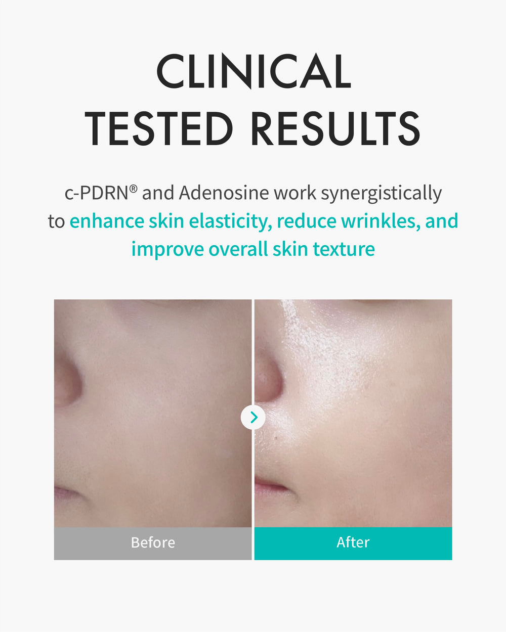 Mascarilla REJURAN aplicada en rostro, piel suave y nutrida