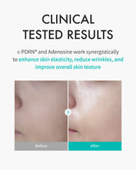 Mascarilla REJURAN aplicada en rostro, piel suave y nutrida