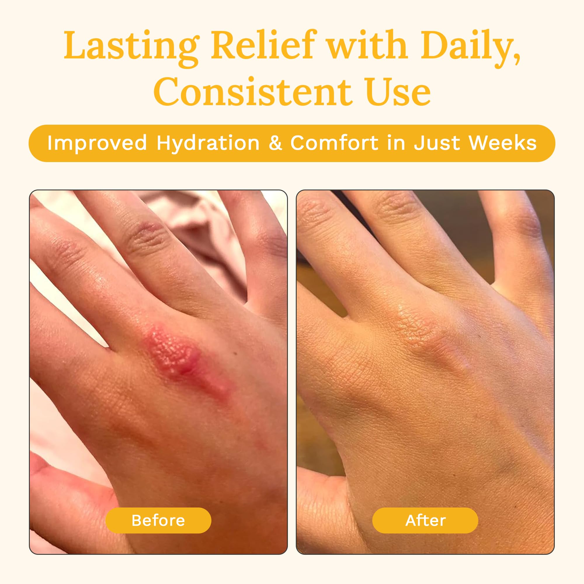 Rejuvaskin Skin Recovery Cream calendula plant depicts gentle botanicals for sensitive skin