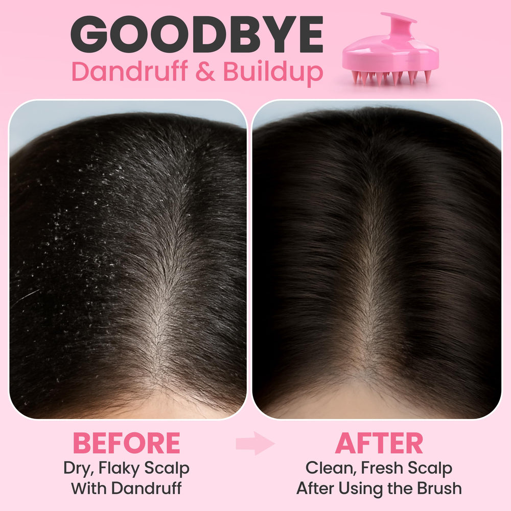 RELAXXO scalp massager used with shampoo in the shower for thorough cleansing