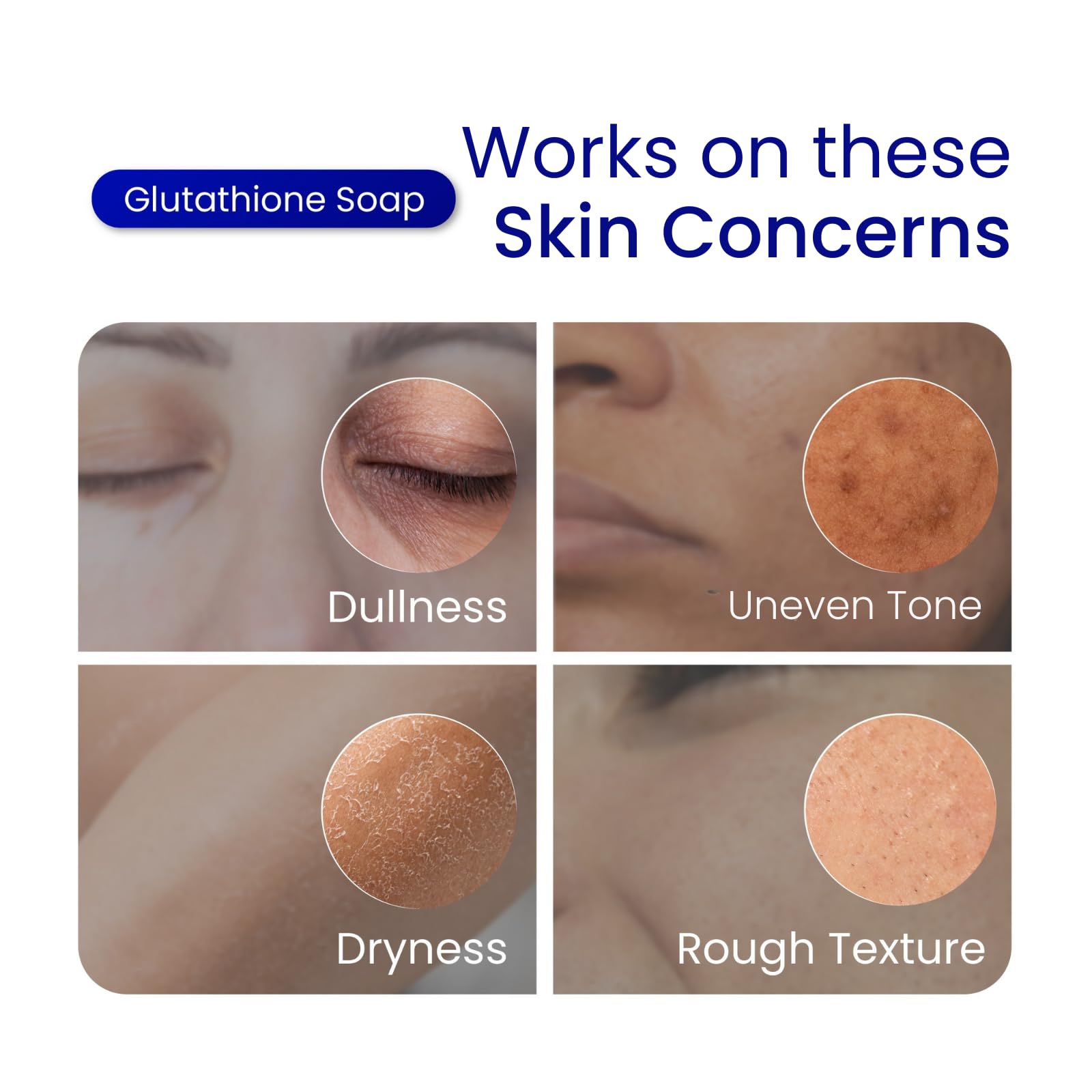 Relumins Glutathione Soap bar may show quick surface improvements.
