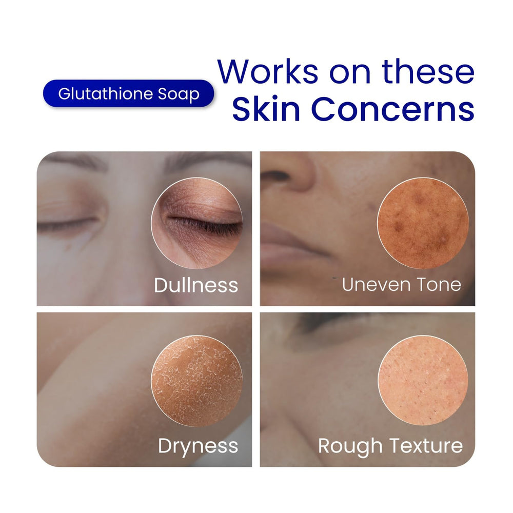 Relumins Glutathione Soap bar may show quick surface improvements.