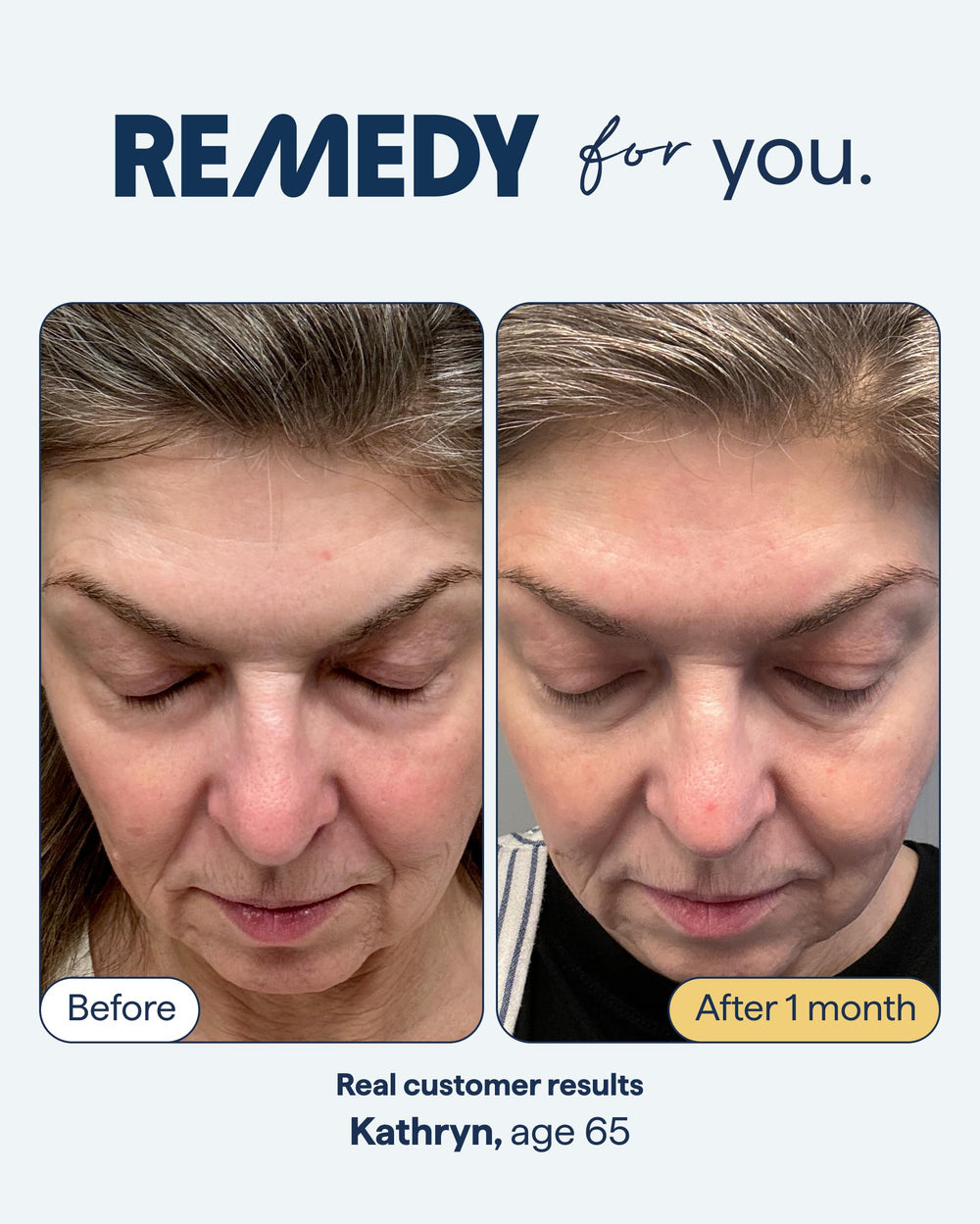 Remedy Science Anti-Aging Serum gel-lotion texture ready for rapid absorption