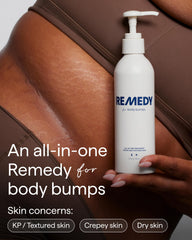 Remedy Science Body Lotion texture swirl showing rich hydration for dry skin.