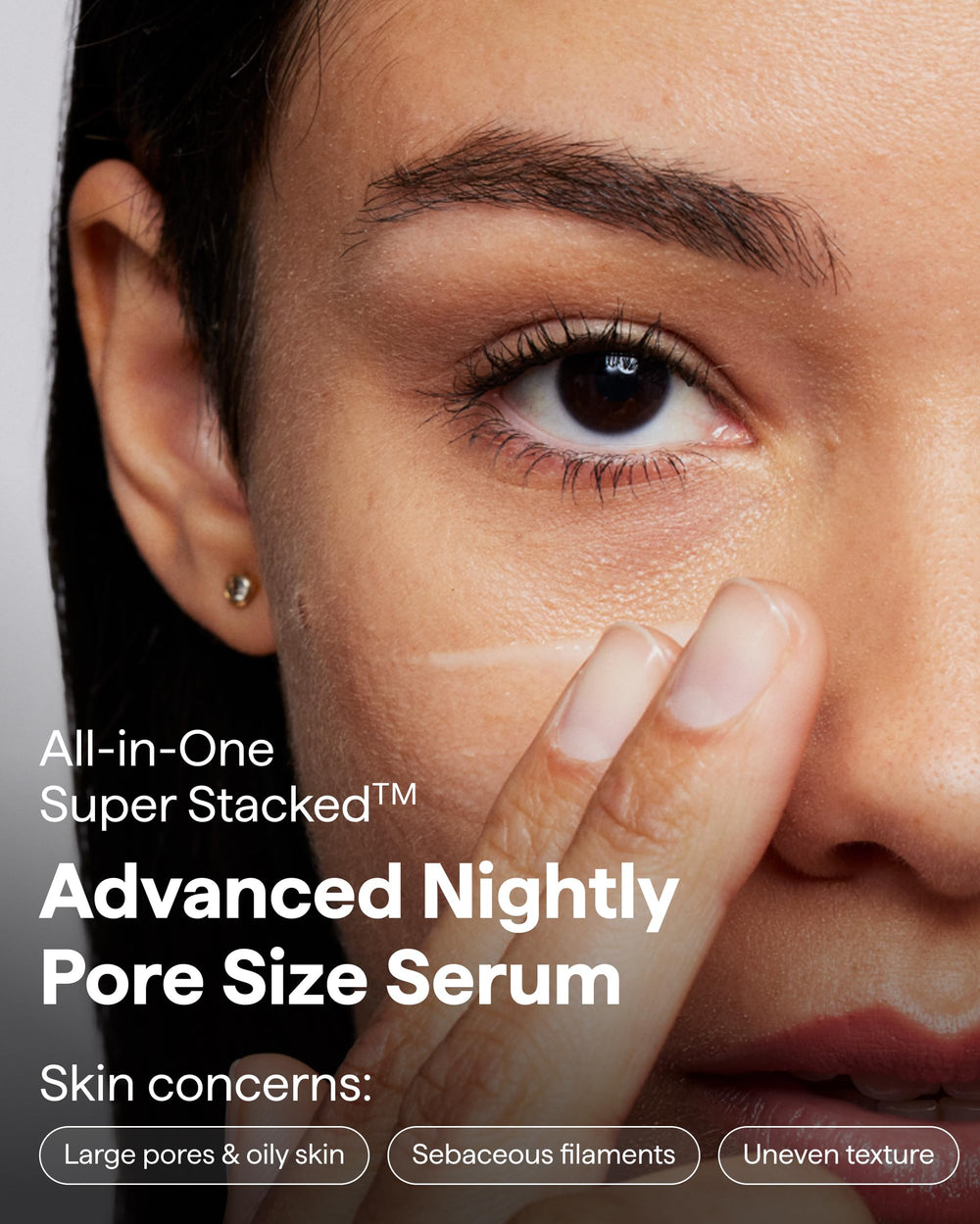 Remedy Science encapsulated retinol 0.3% improves skin turnover and texture.
