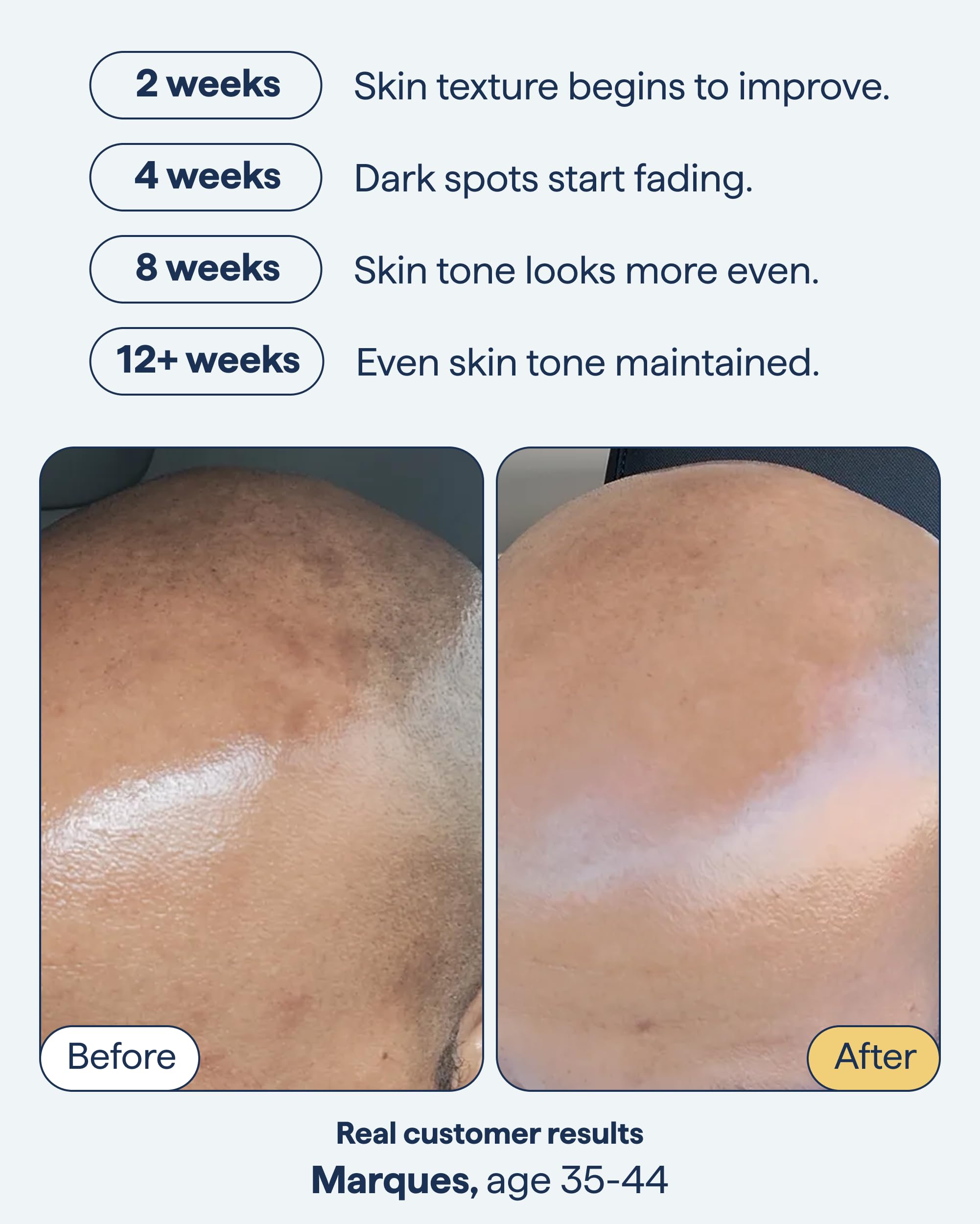 Remedy Science encapsulated retinol visual emphasizes gentle nightly target support.