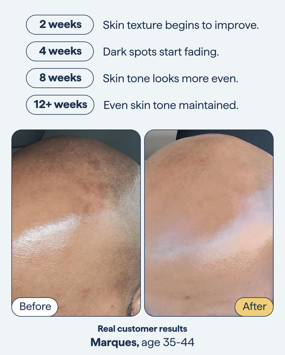 Remedy Science encapsulated retinol visual emphasizes gentle nightly target support.