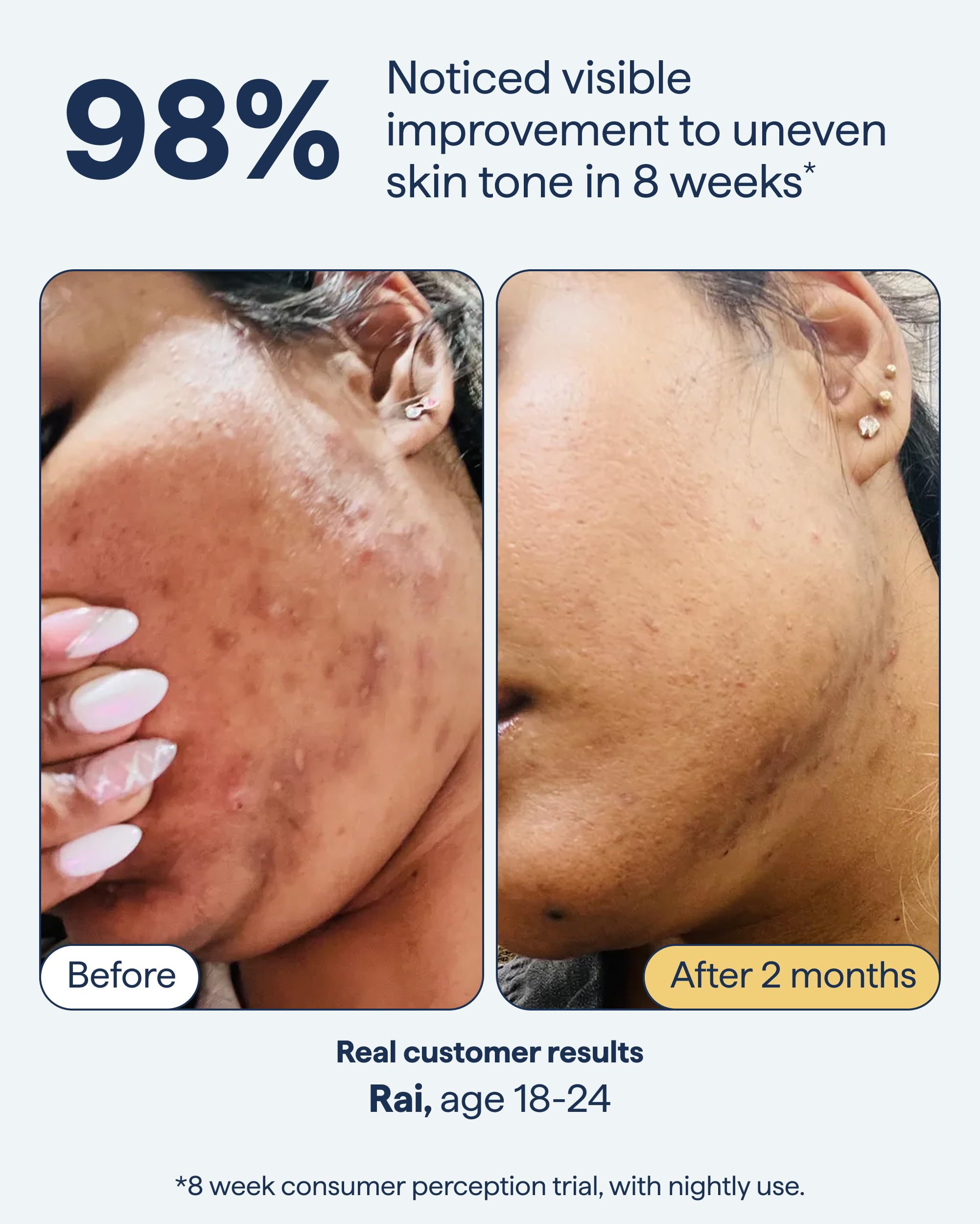 Remedy Science tranexamic acid illustration conveys discoloration reduction concept.