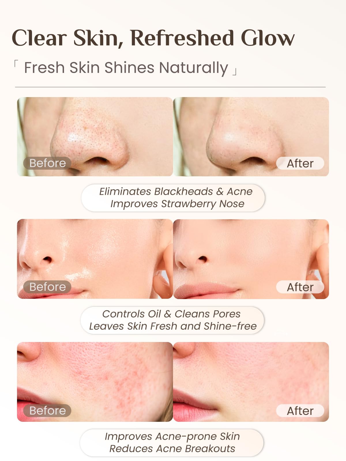 Rena Chris bristle cleanse side helps gentle daily cleansing.