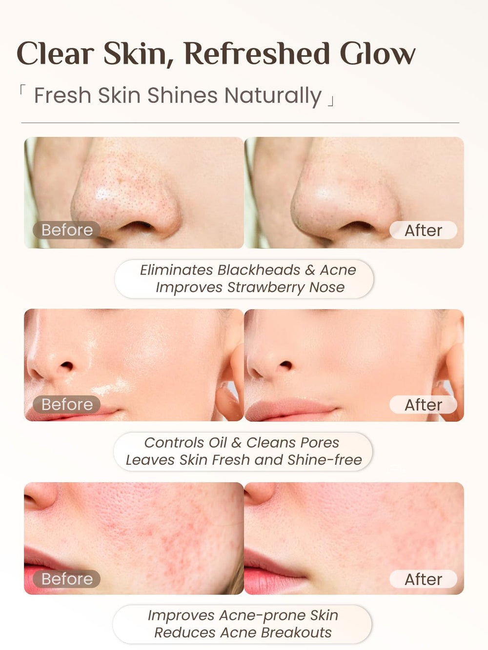Rena Chris bristle cleanse side helps gentle daily cleansing.