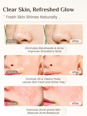 Rena Chris bristle cleanse side helps gentle daily cleansing.