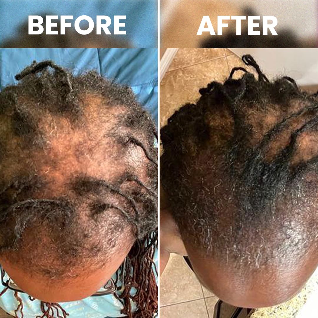 Rennora Hair Growth Serum natural herbs emphasis on key botanicals
