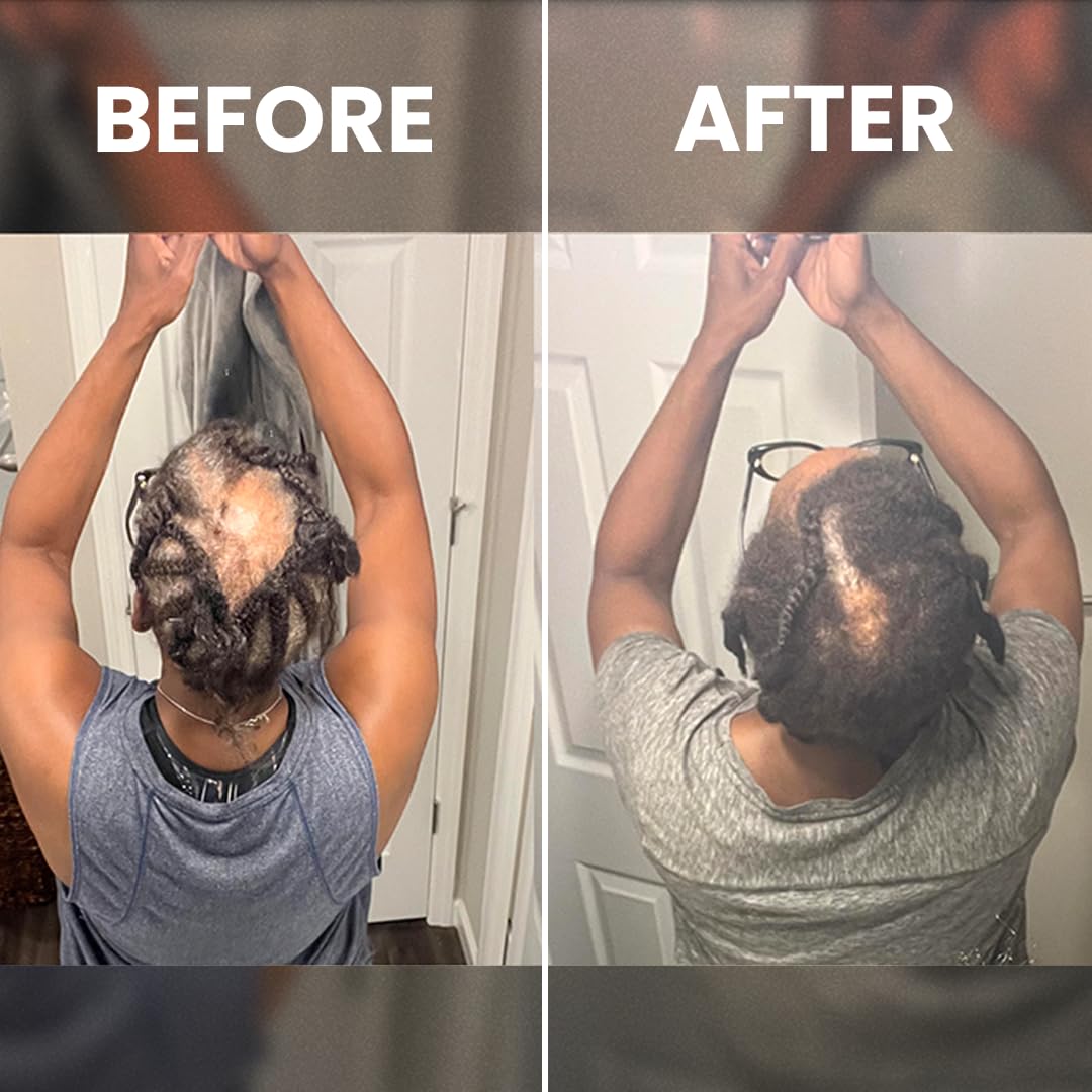 Rennora Hair Growth Serum lifestyle shot fits into daily routine