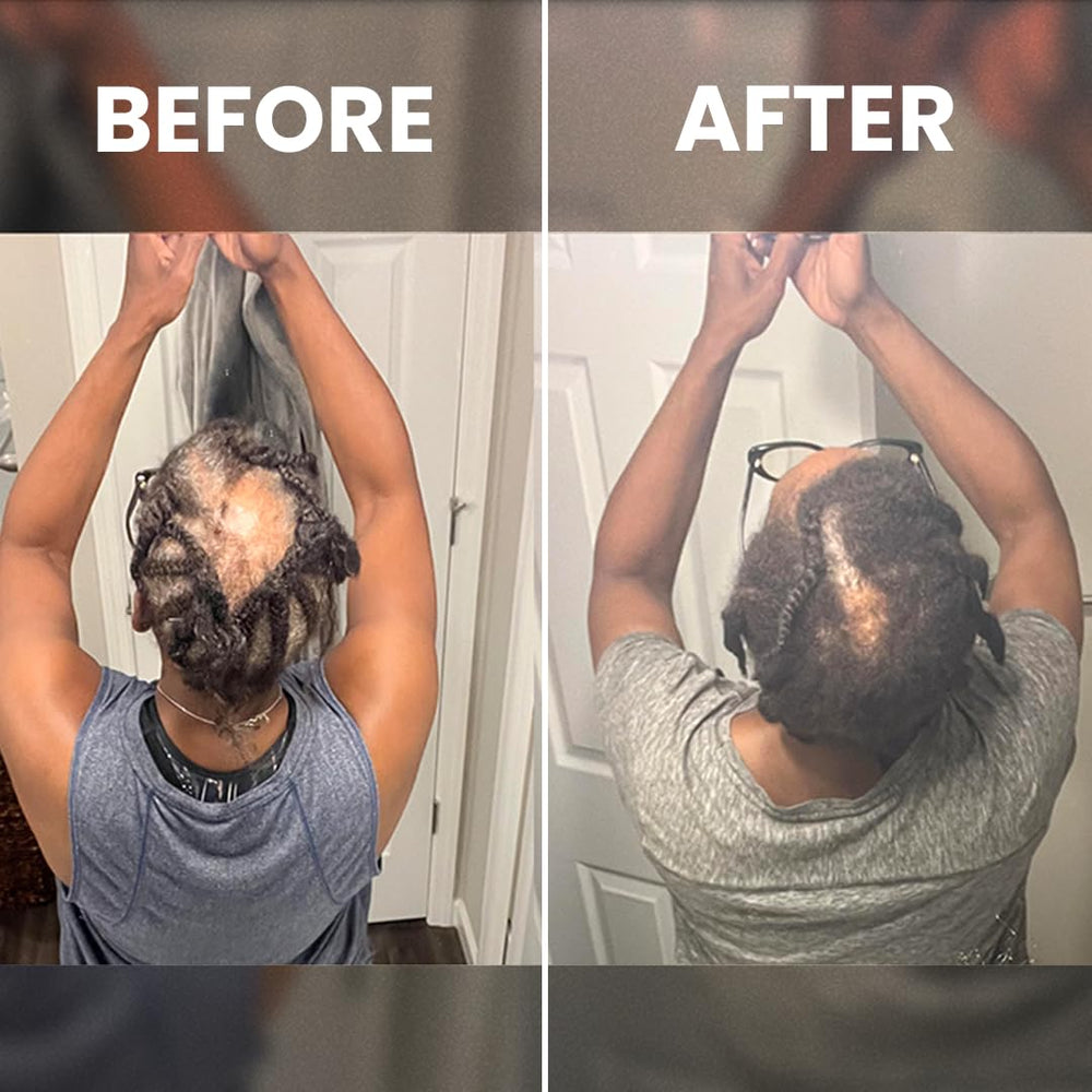 Rennora Hair Growth Serum lifestyle shot fits into daily routine