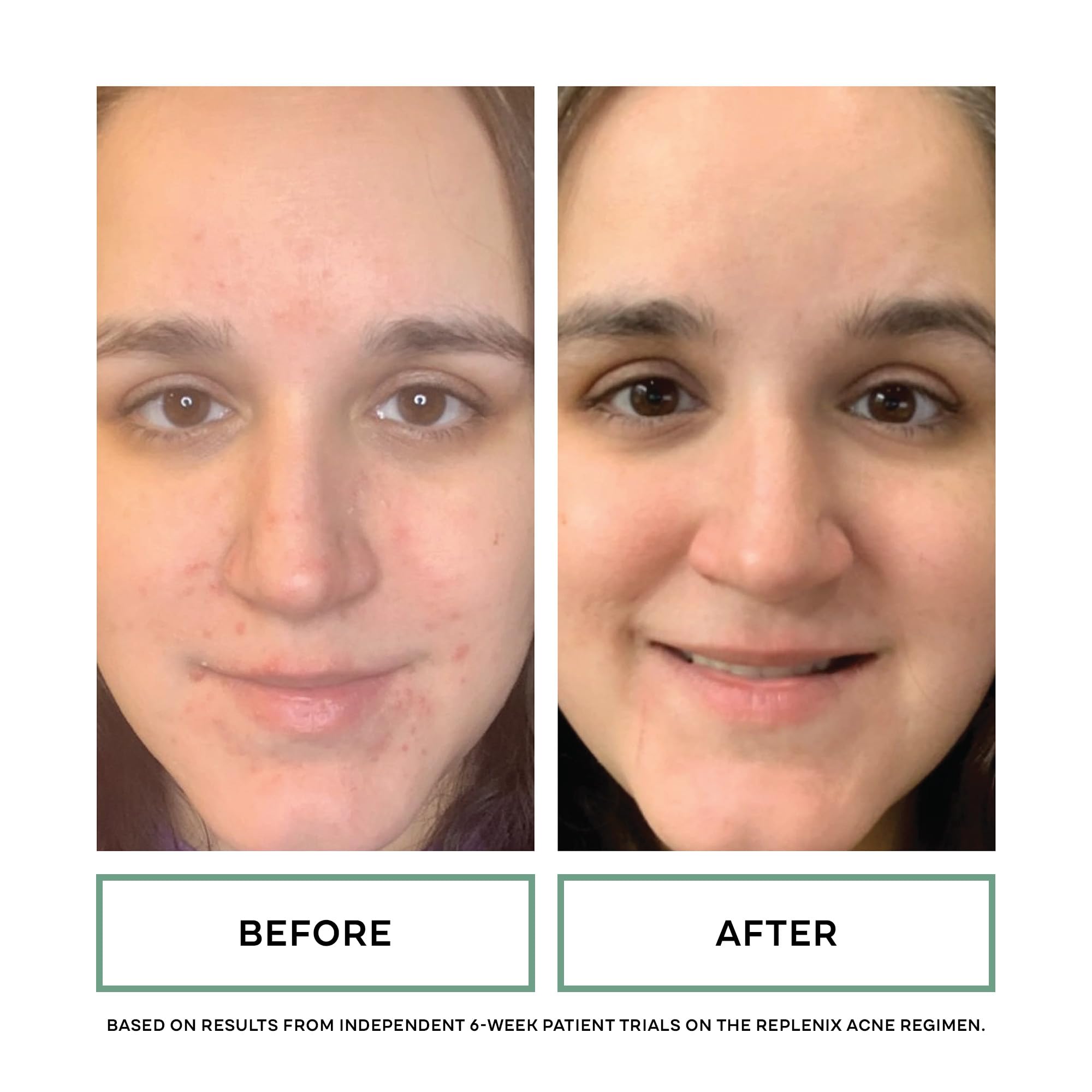 Dermatologist-recommended, pH-balanced Replenix skincare detail