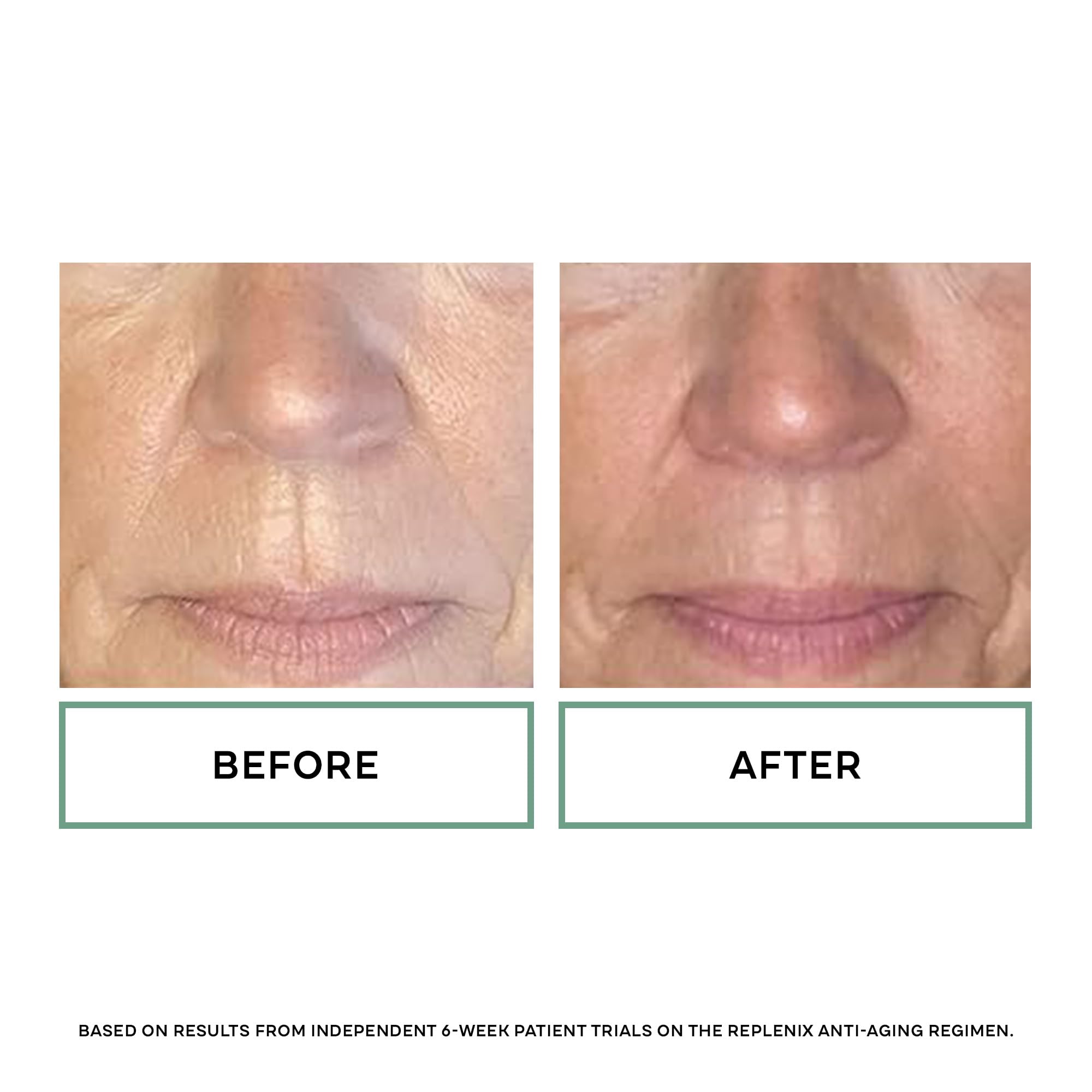 Replenix Glycolic 20% texture on skin shows balanced absorption.