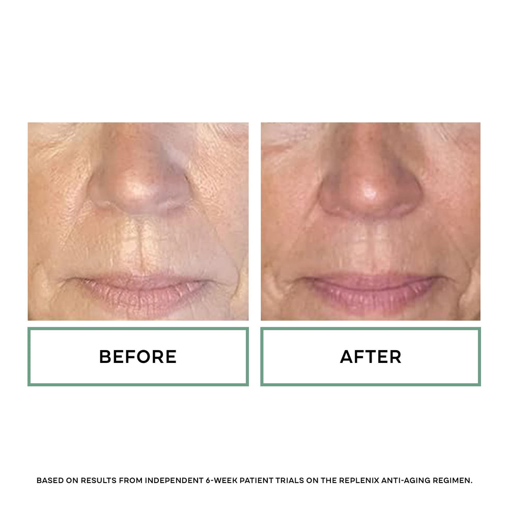 Replenix Glycolic 20% texture on skin shows balanced absorption.