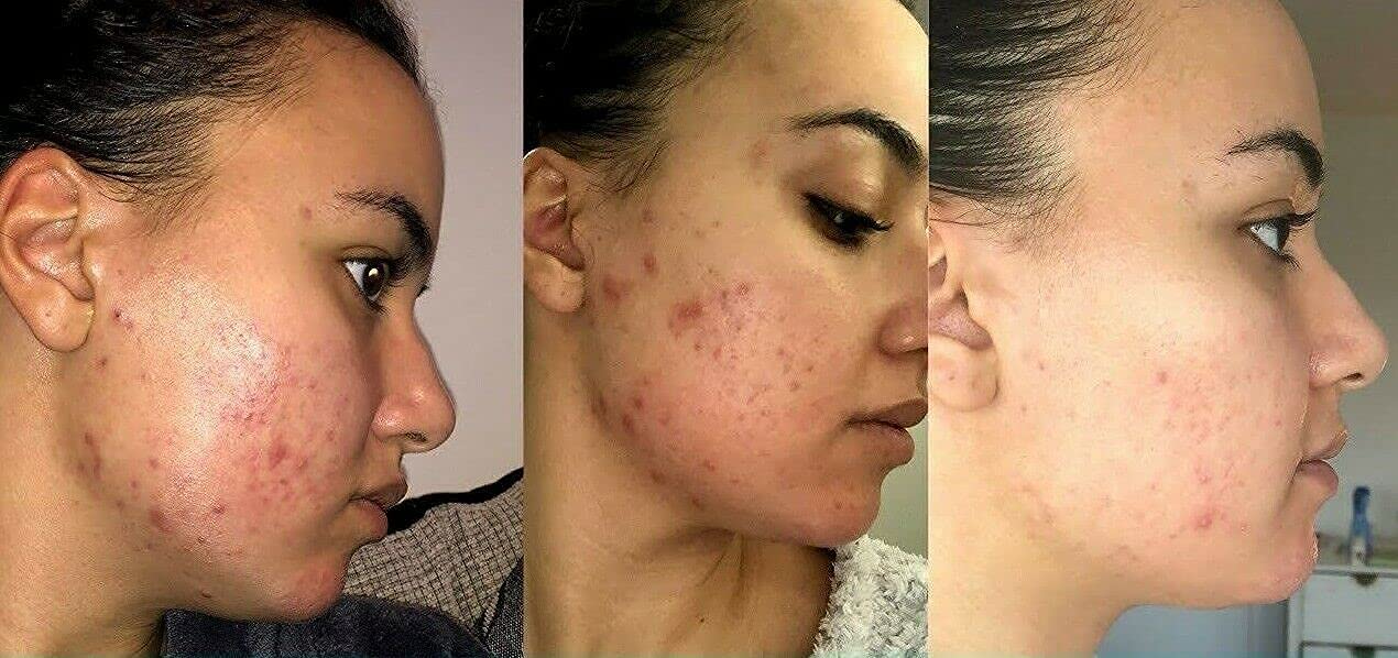 Night skincare routine featuring Retinol Gel 0.1% for texture focus.