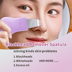 REVEX Blackhead Remover Tool dual-function close-up showing concave and convex spatula.