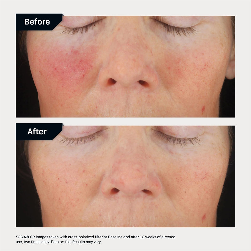Revision Skincare C+ Correcting Complex close-up ingredients reveal MelaPATH tech and prebiotic support.