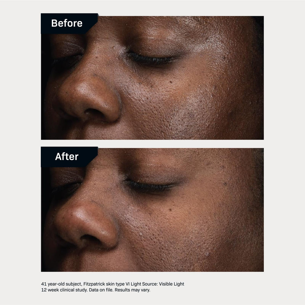 Revision Skincare D·E·J Daily Boosting Serum packaging highlights premium formula.