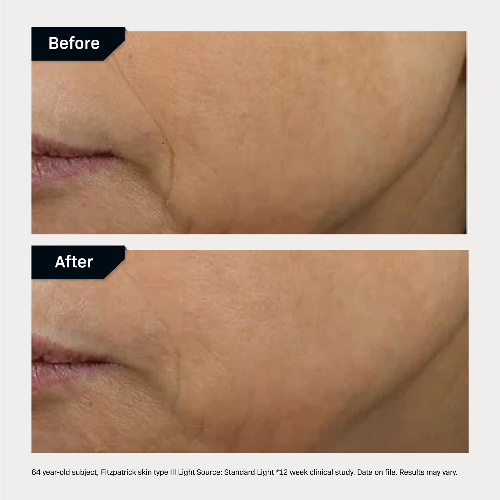 Morning application scene with gentle pump on cleansed skin.