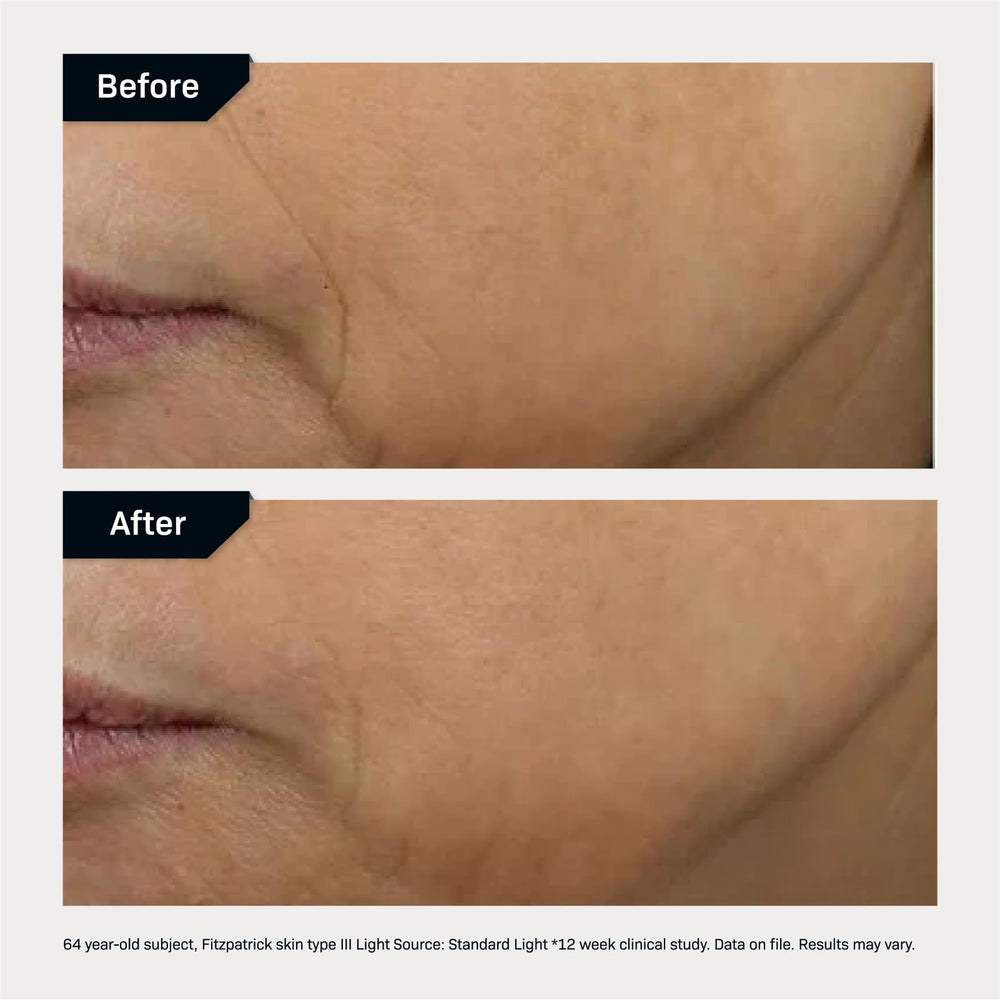 Morning application scene with gentle pump on cleansed skin.