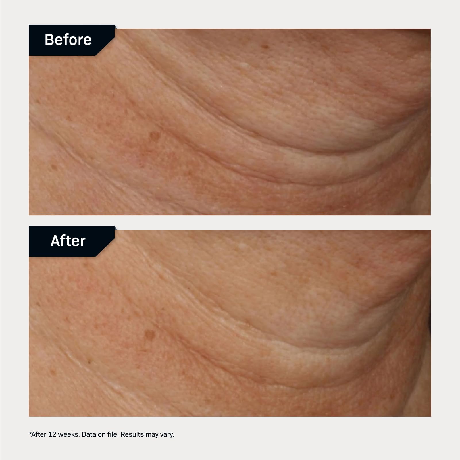 Nectifirm Advanced neck cream texture close-up on the neck
