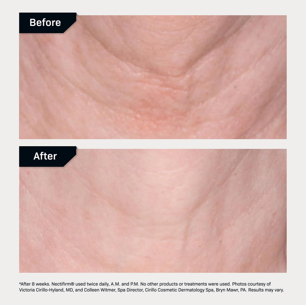 Revision Skincare Nectifirm Advanced wrinkle-detail—smoother-looking neck skin.