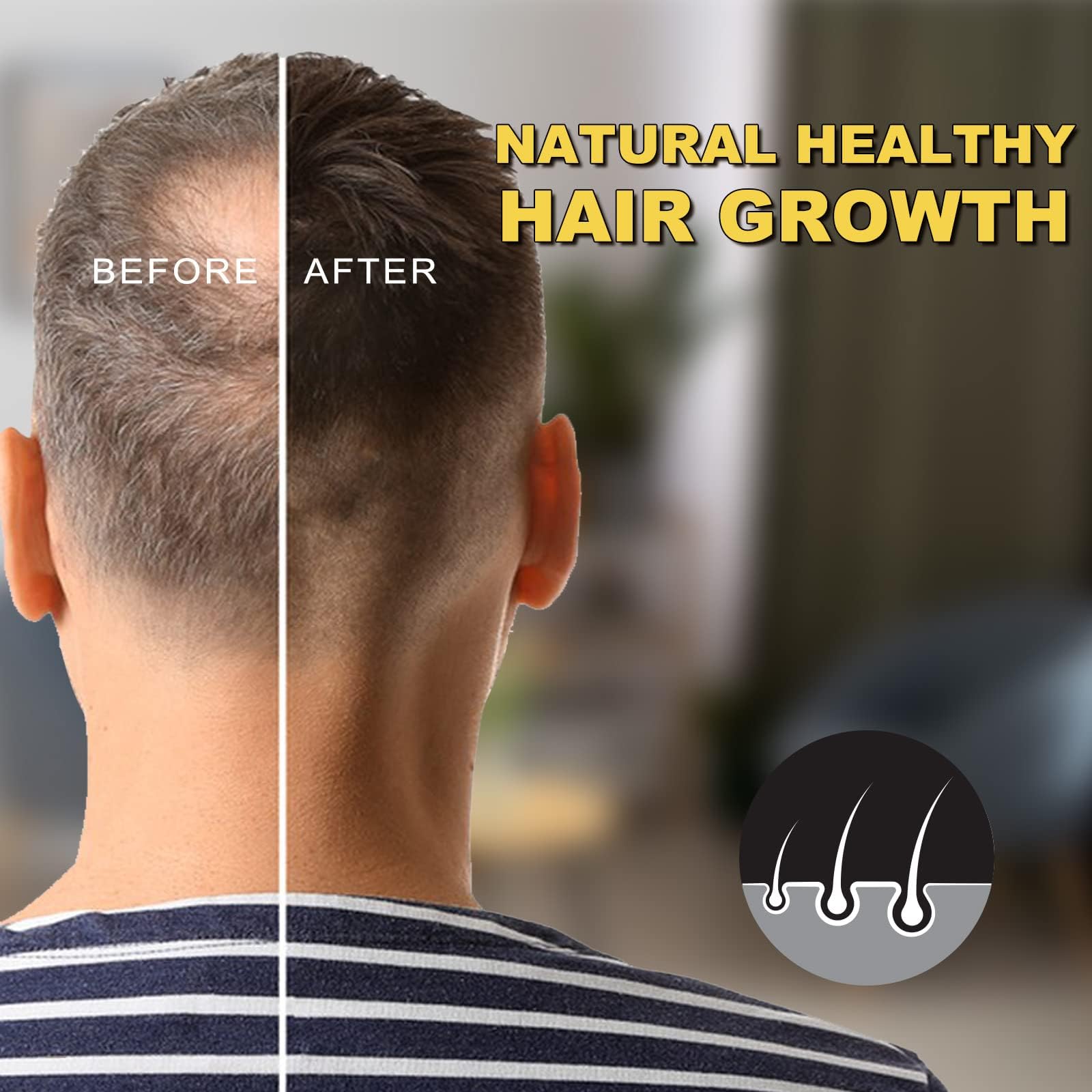 Uso para hombres y mujeres con cabello fino para mayor densidad.