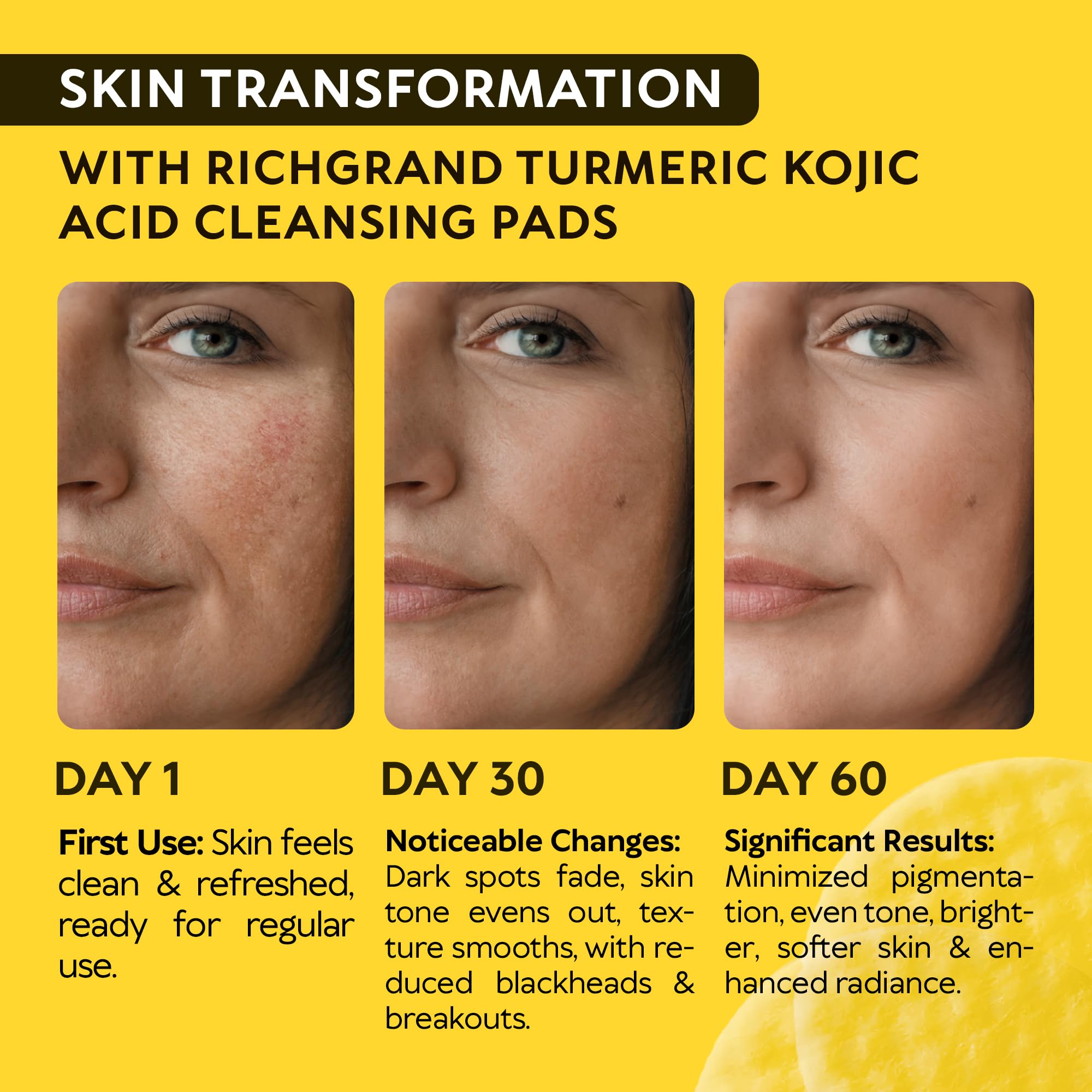 RICHGRAND disco exfoliante suave para textura más lisa