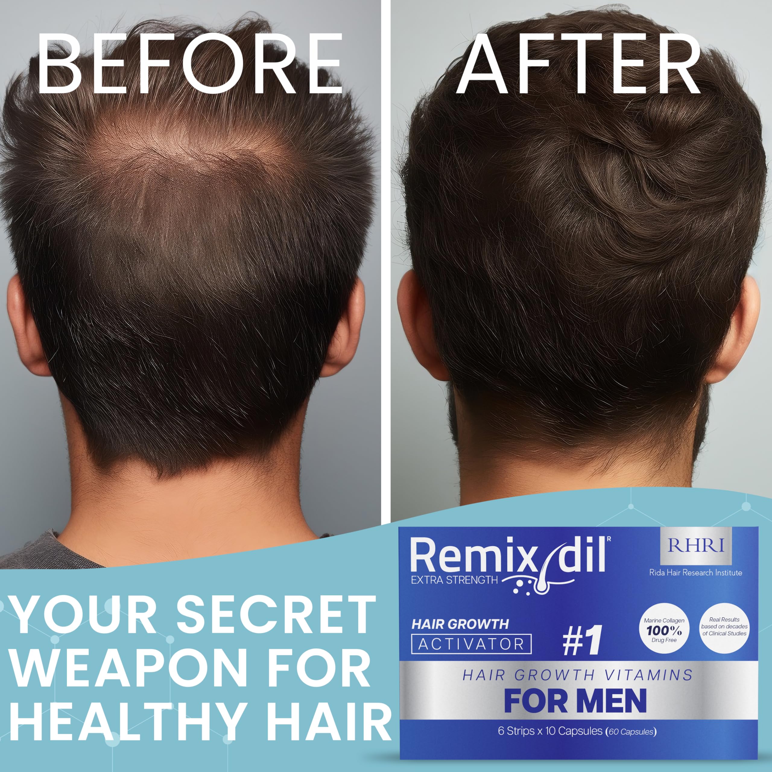 Rida Hair Growth Vitamins beard-support usage illustrates targeted facial hair growth