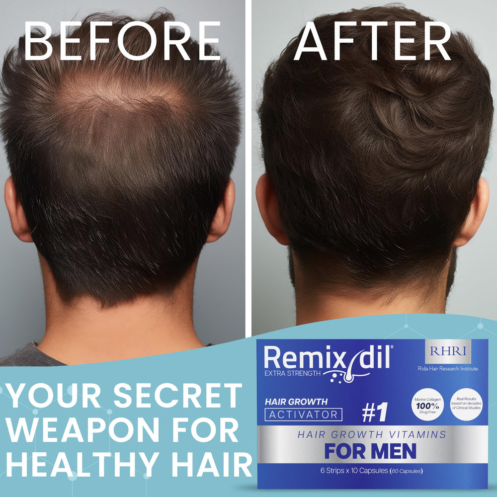 Rida Hair Growth Vitamins beard-support usage illustrates targeted facial hair growth
