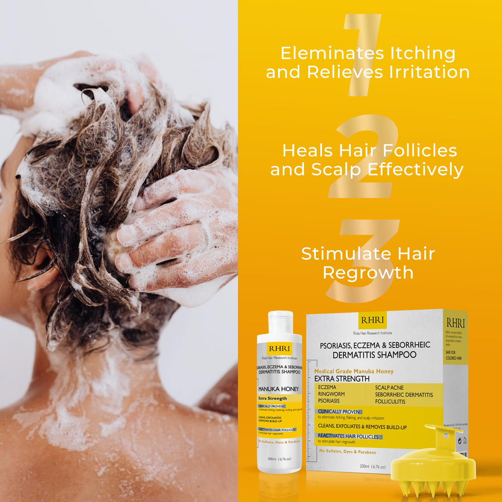 Rida Hair psoriasis shampoo after-use closeup reveals refreshed scalp appearance