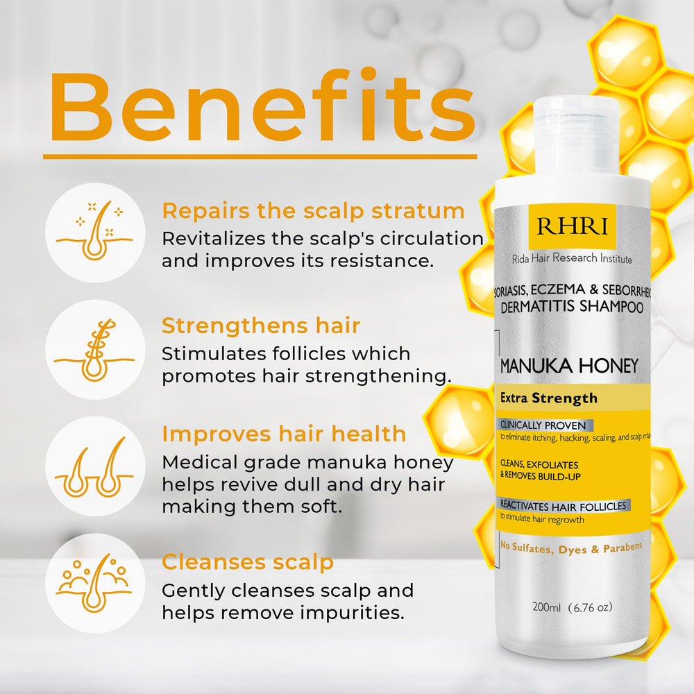 Rida Hair psoriasis shampoo foam lather for deep cleansing of flaky scalp