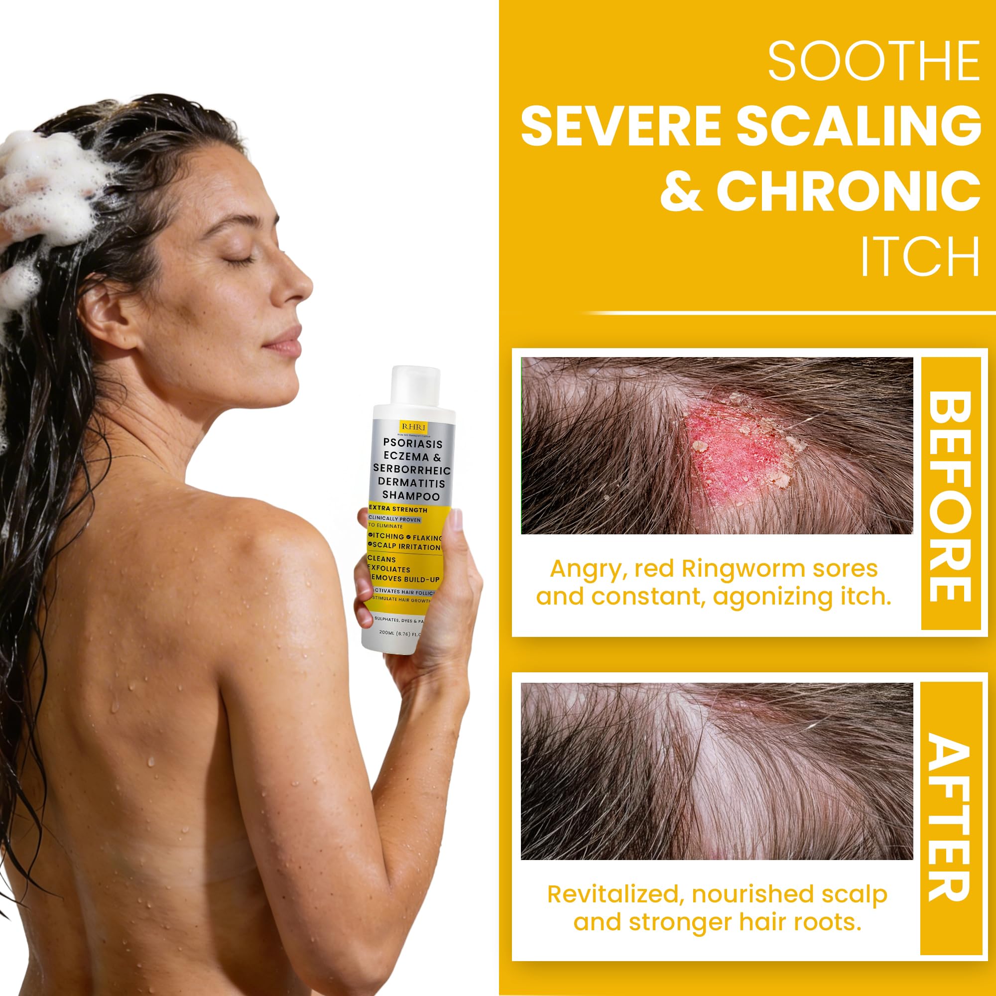 Rida Hair psoriasis shampoo texture showing lightweight formula for easy rinse