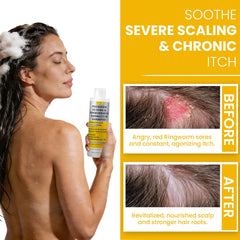 Rida Hair psoriasis shampoo texture showing lightweight formula for easy rinse